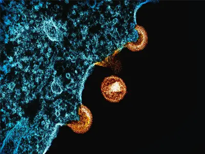 national-institute-of-allergy-and-infectious-diseases-Jr3FJg1krfk-unsplash_musiics